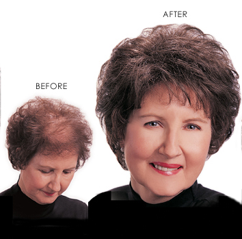 Jon Renau Wigs : Perfect Blend Ruth (#551)